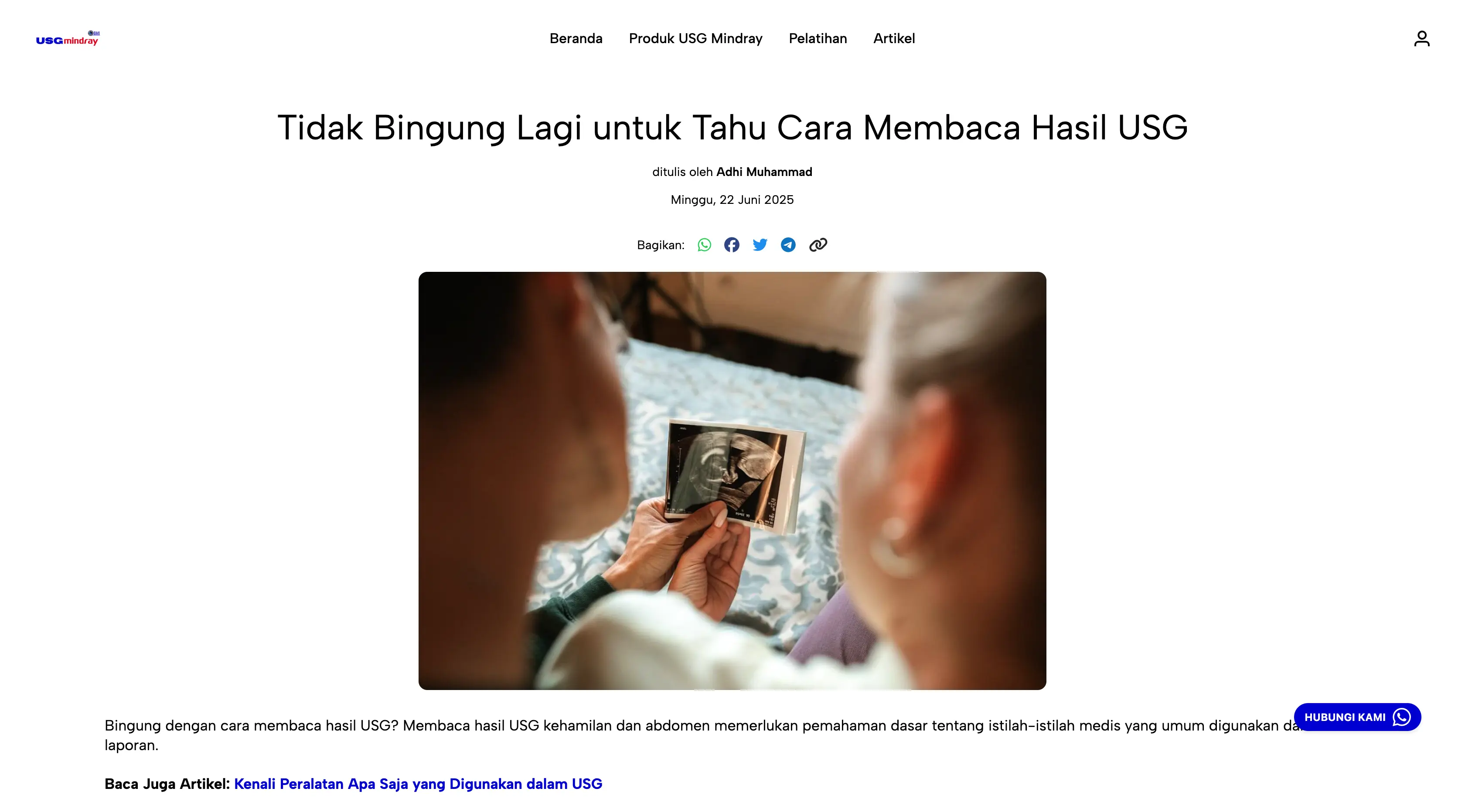 Tampilan USG Mindray